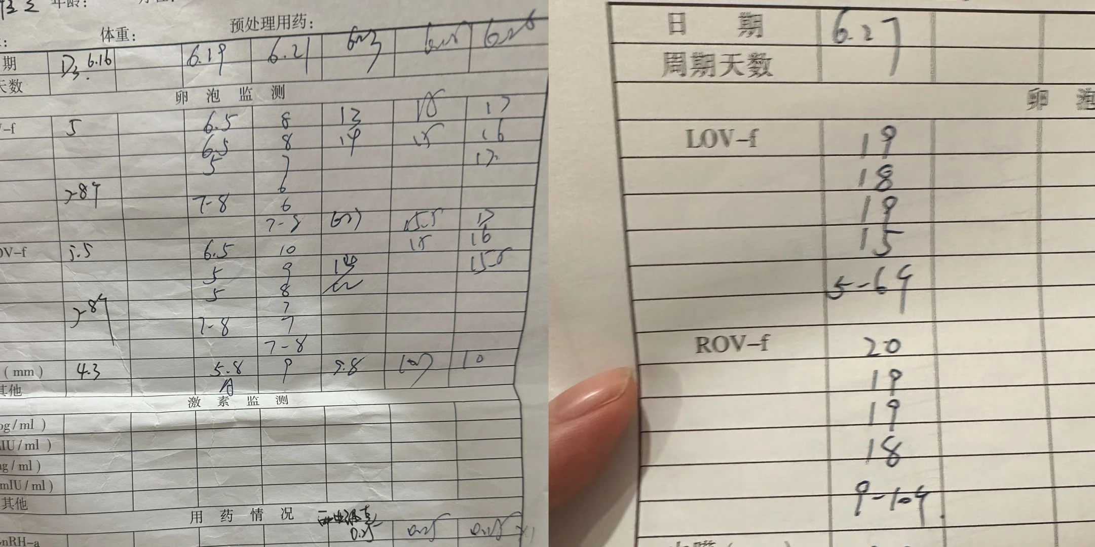 双胞胎试管：心理准备同样重要